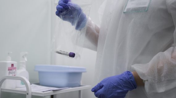 За сутки в Крыму коронавирус выявили у 26 человек