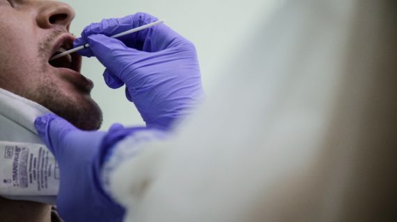 Срок действия ПЦР-теста на коронавирус в России могут сократить до 48 часов