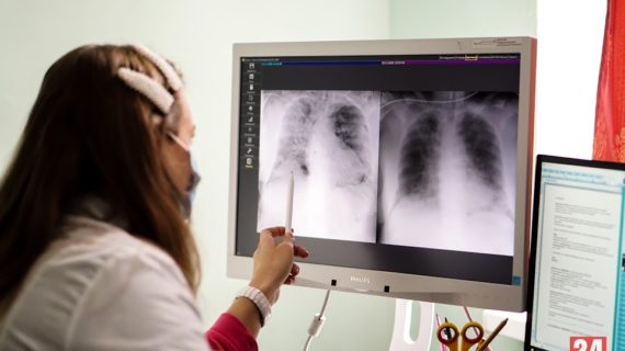 В 2022 году Крым получит средства на выплаты медикам за выявленные онкологические заболевания у пациентов